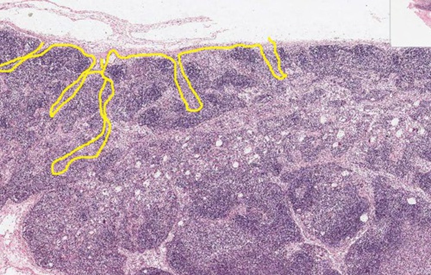 <p>Extensions of the capsule creates division of the lymph node</p>