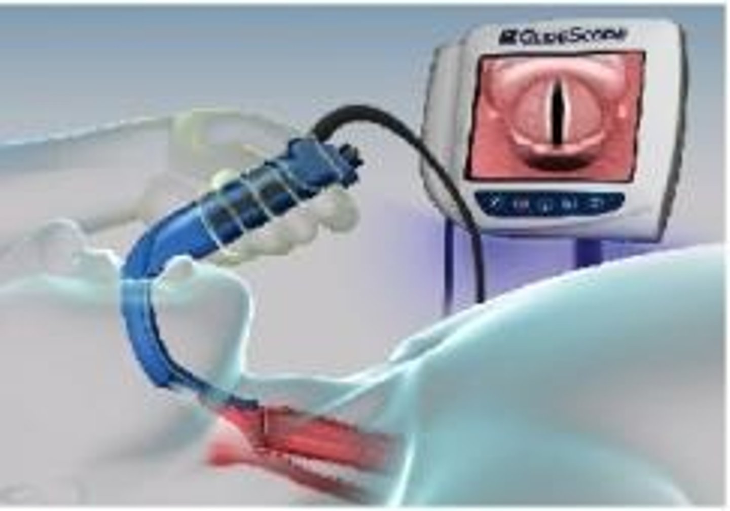 <p>• Process of placing an endotracheal tube to provide a patent airway</p><p>• Preparation, sedation, paralysis</p><p>Nursing Role:</p><p>• Gather supplies/equipment</p><p>• Administer medications</p><p>• Monitor VS</p>