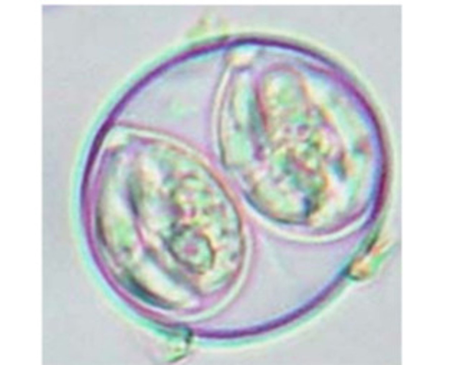 <p>ID the following parasite (dogs and cats)</p>