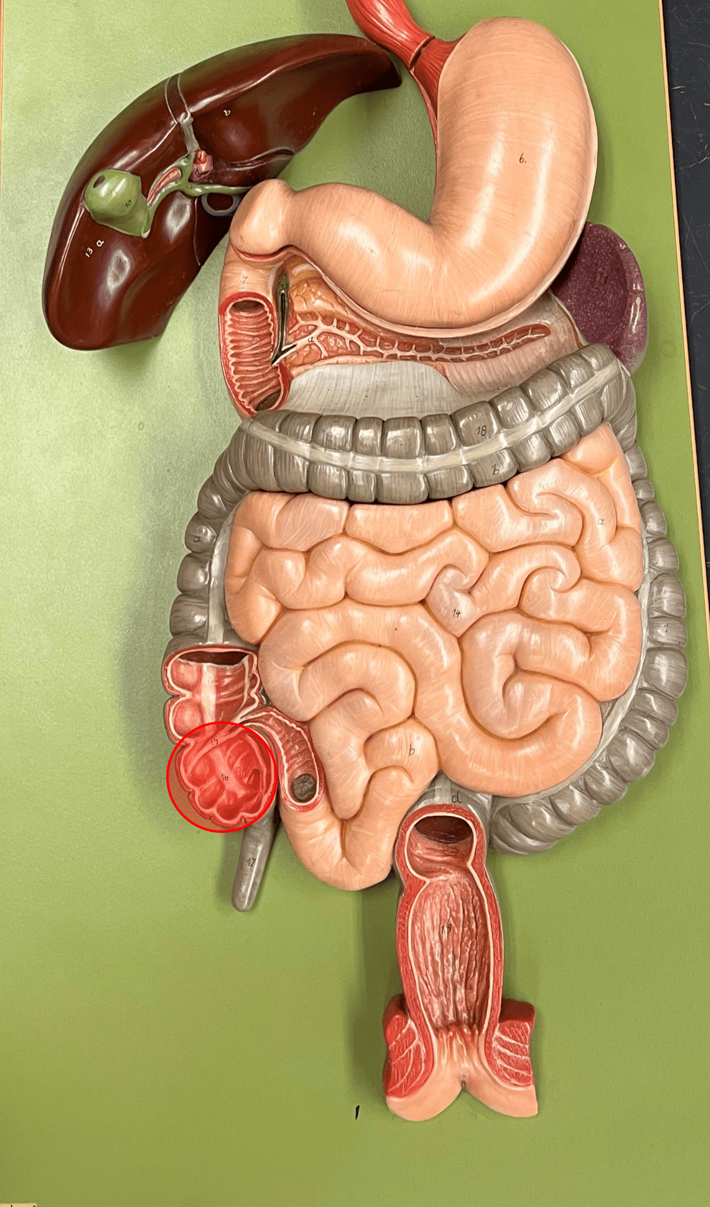 • A region of the large intestine.

• A blind pouch arising from the ileocecal valve.