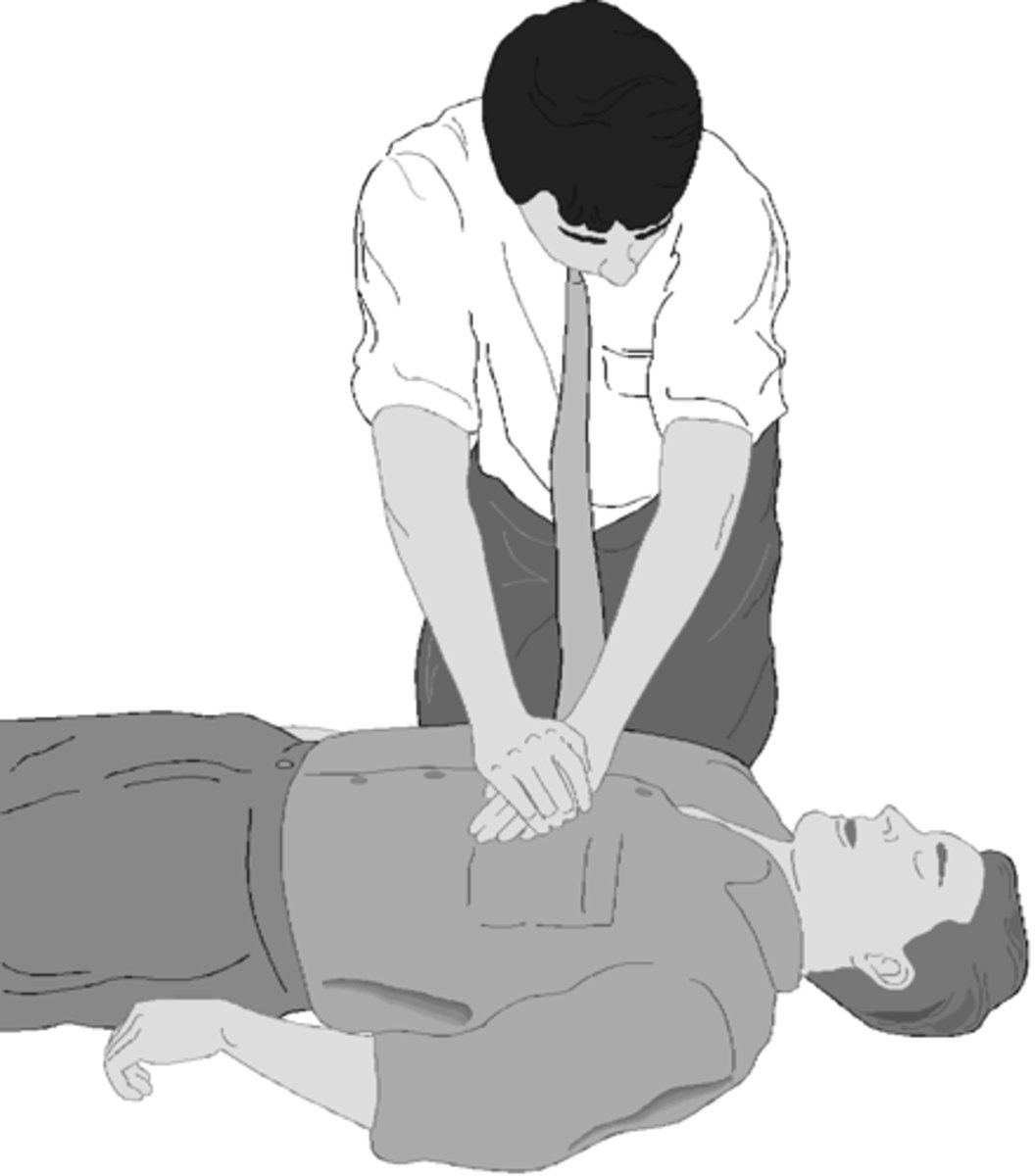 <p>techniques that allow the rescuer to artificially pump the heart, delivering blood to the body and bringing oxygen to the lungs</p>