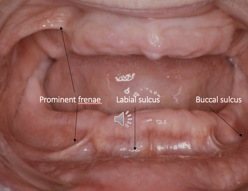 <p>what other intraoral structures do we need to record </p>