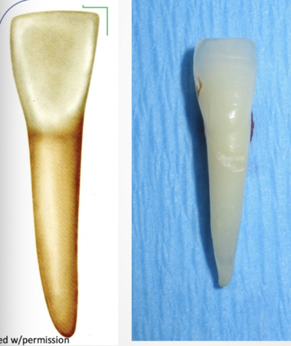 <p>- Crown slightly wider mesiodistally than mandibular central crown</p><p>- Root longer than mand. central; total tooth approx. 2mm longer</p><p>- M incisal angle sharp, nearly right angle</p><p>- D side of insisal angle rounded</p>
