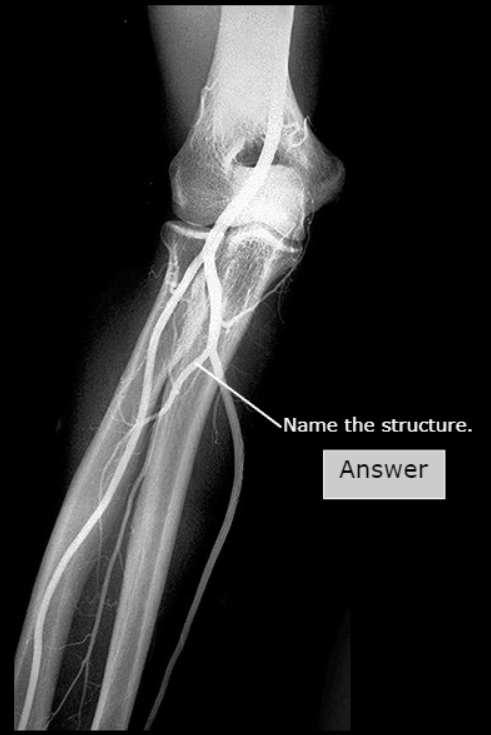 <p>What artery is this</p>