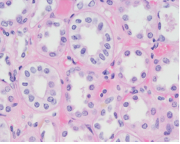 <p>What tissue is this?<br>Where is the location?</p>