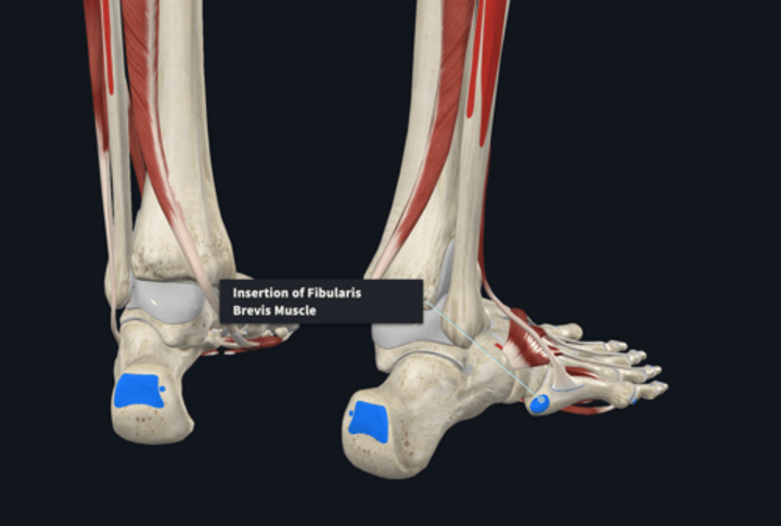 <p>Insertion: Peroneus Brevis</p>