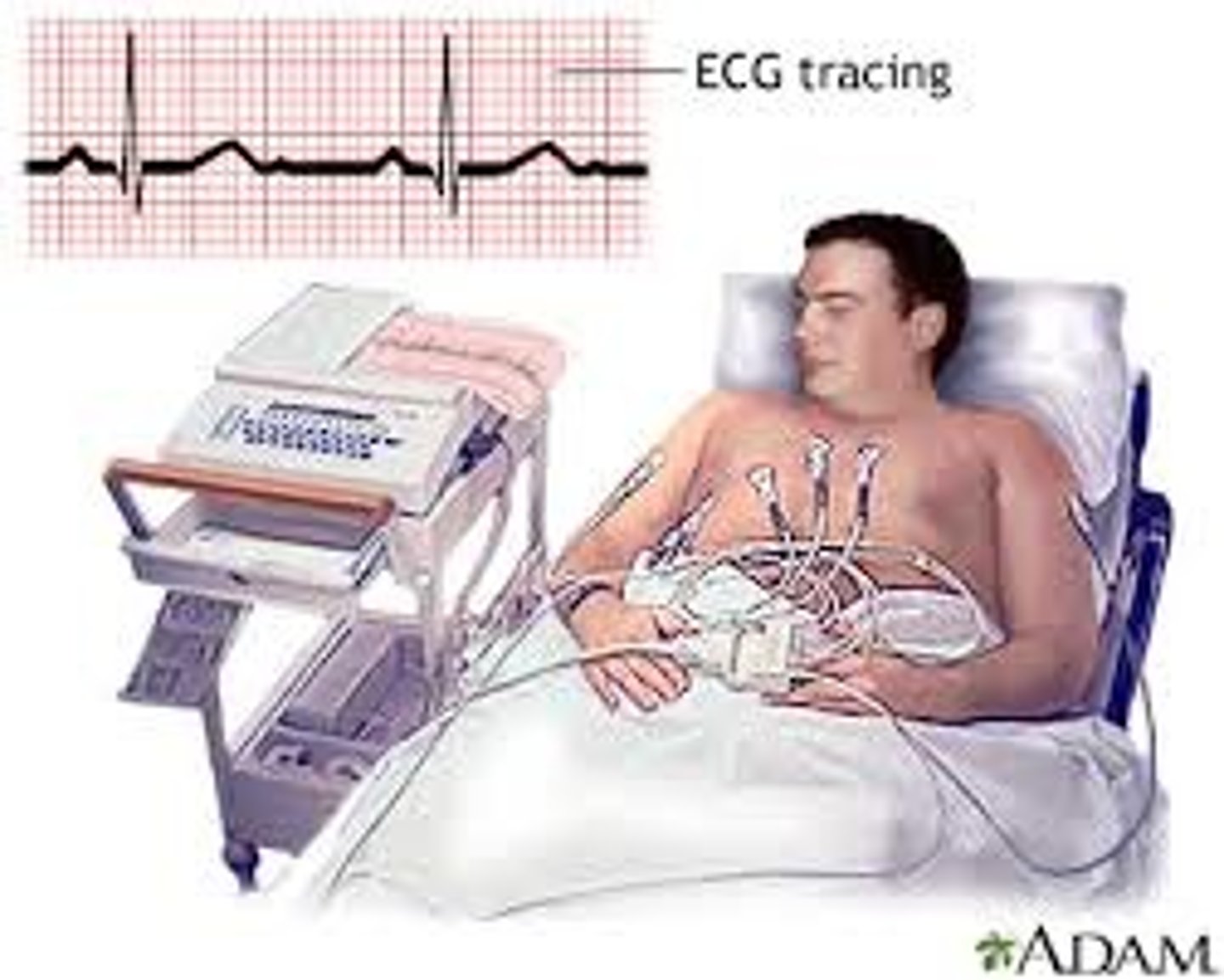 <p>taking a recording of the patients heart beat</p>