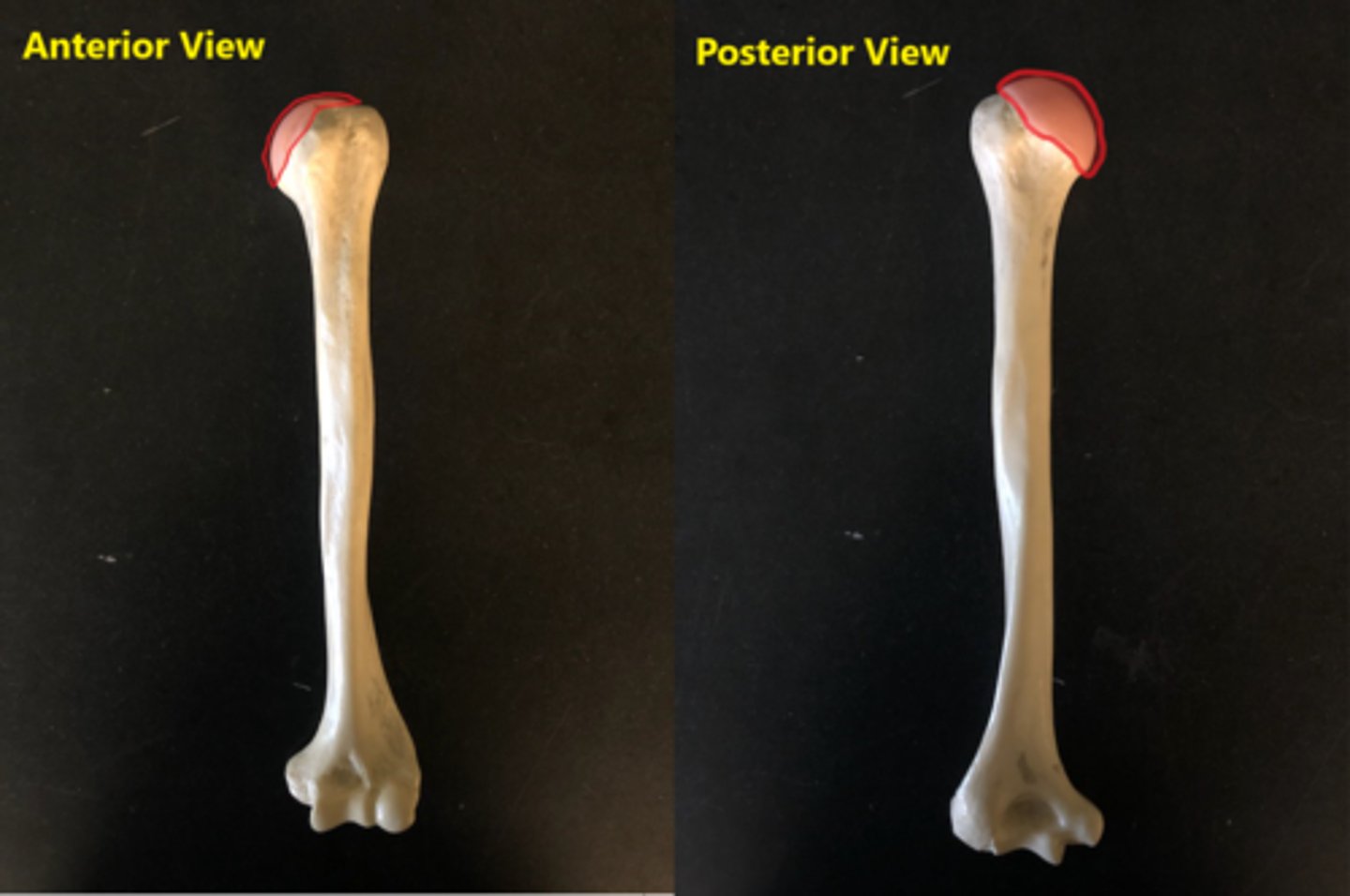 <p>Medial, fits in scapula round portion (glenoid cavity)</p>