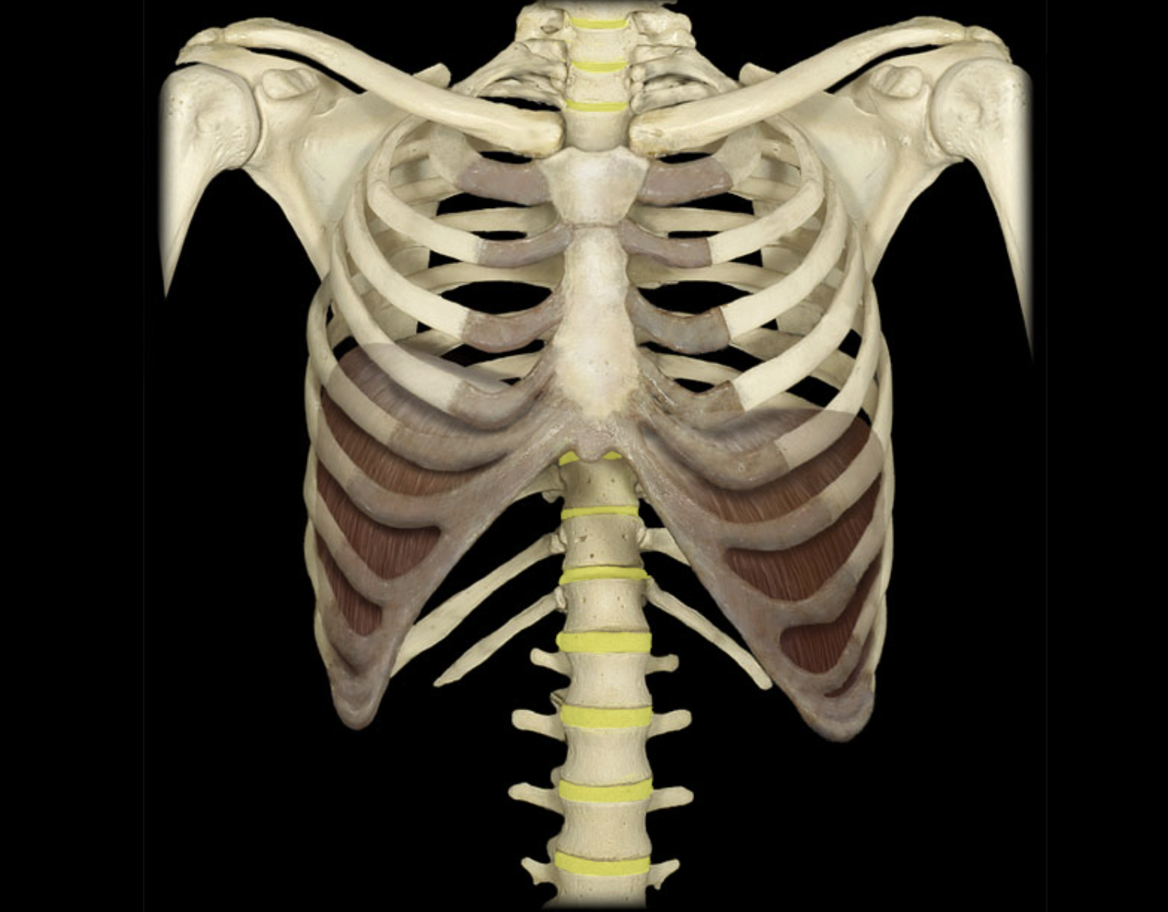 <p>Location:</p><p class="p1">• Between vertebral bodies (C2 to S1)</p><p class="p1">Description:</p><ul><li><p>﻿﻿Outer part: anulus fibrosus consisting of a fibrocartilage ring</p></li><li><p>﻿﻿Inner part: nucleus pulposus composed of mucoid material</p></li></ul><p class="p1">Comment:</p><p class="p1">• No disk between atlas (C1 vertebra) and axis (C2 vertebra)</p>