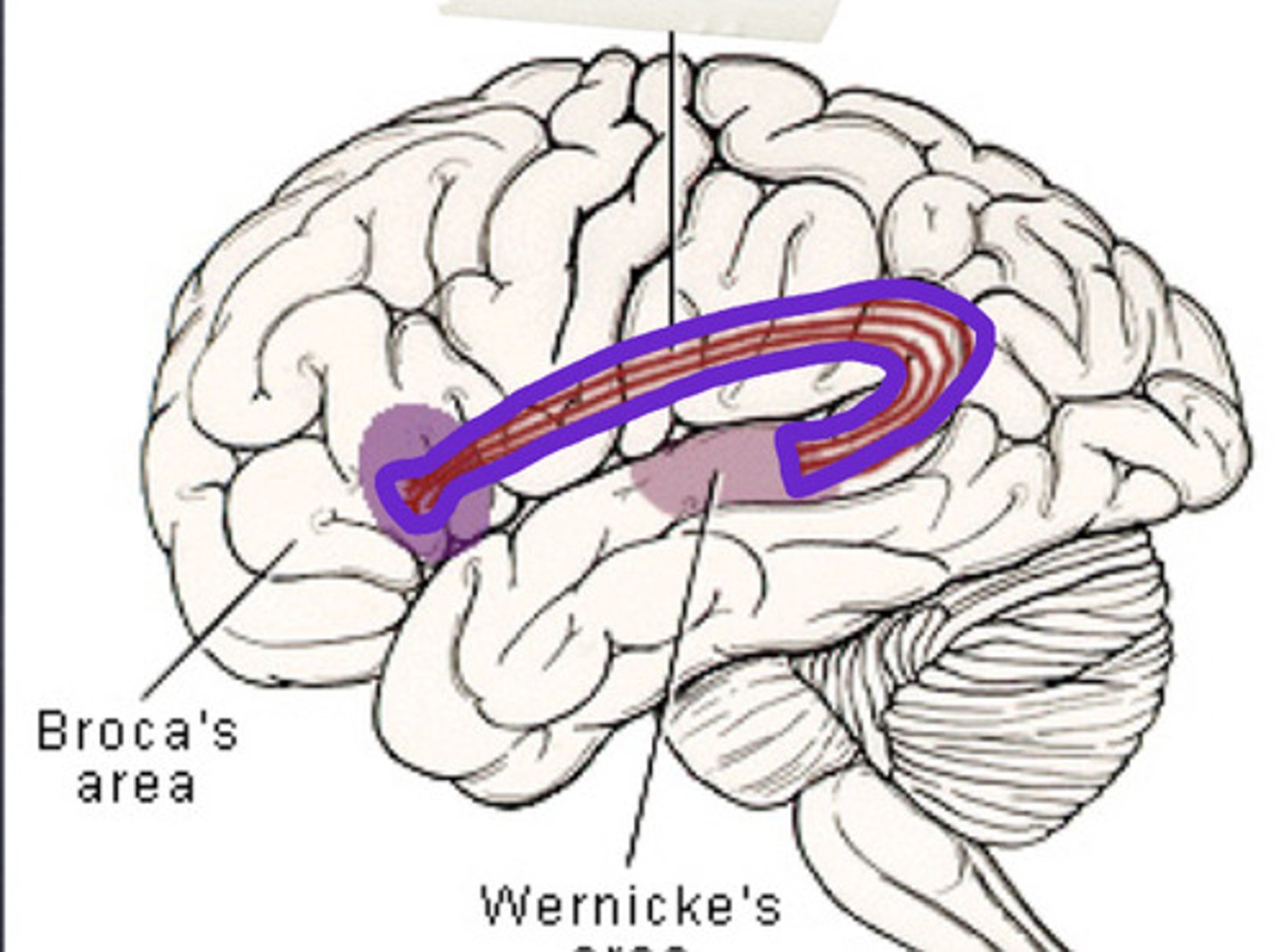 <p>- Connects Wernicke's Area to Broca's Area</p><p>- Links speech sound recognition to production</p><p>- imporant for ability to repeat speech</p>