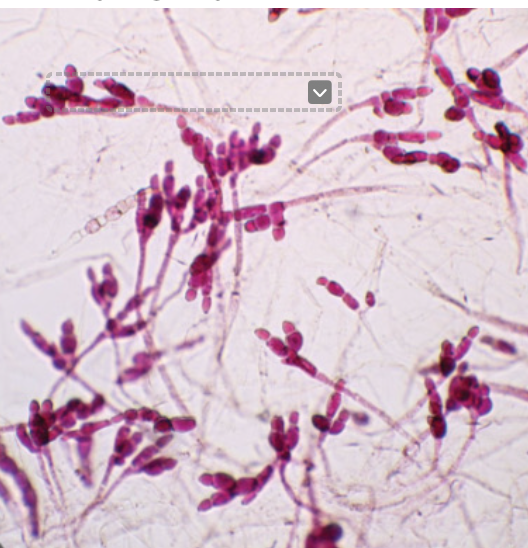 <p>A genus of fungi that belong to the phylum Chytridiomycota, known for their aquatic habitats and unique life cycle stages, including flagellated spores. Diploid dominant</p>