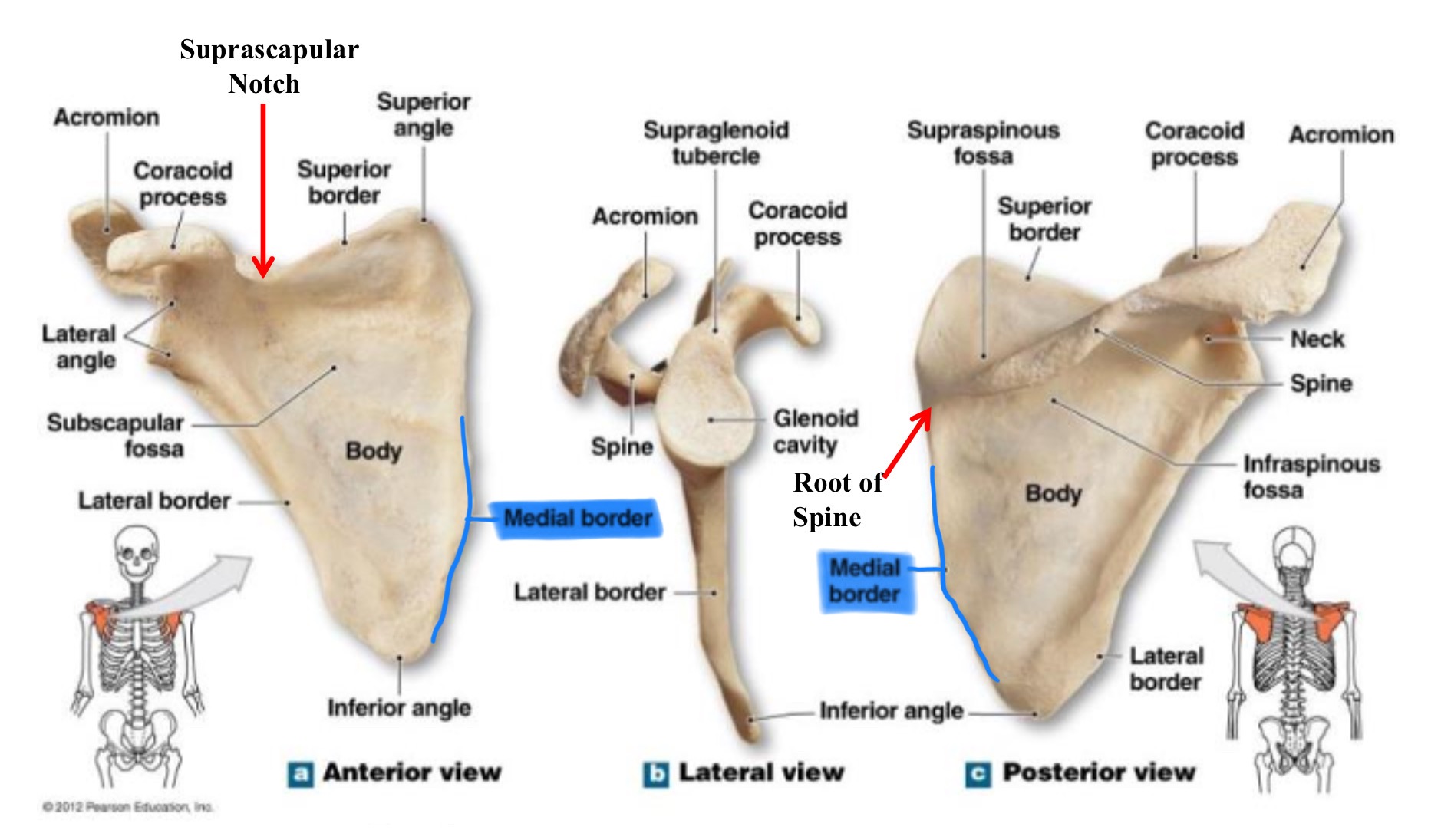 <p>medial border of scapula (vertebral border)</p>