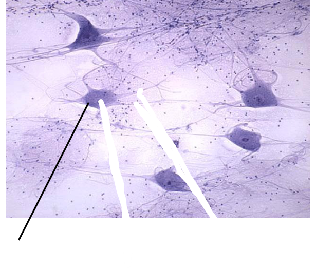 <p>What part of the nervous tissue is this?</p>
