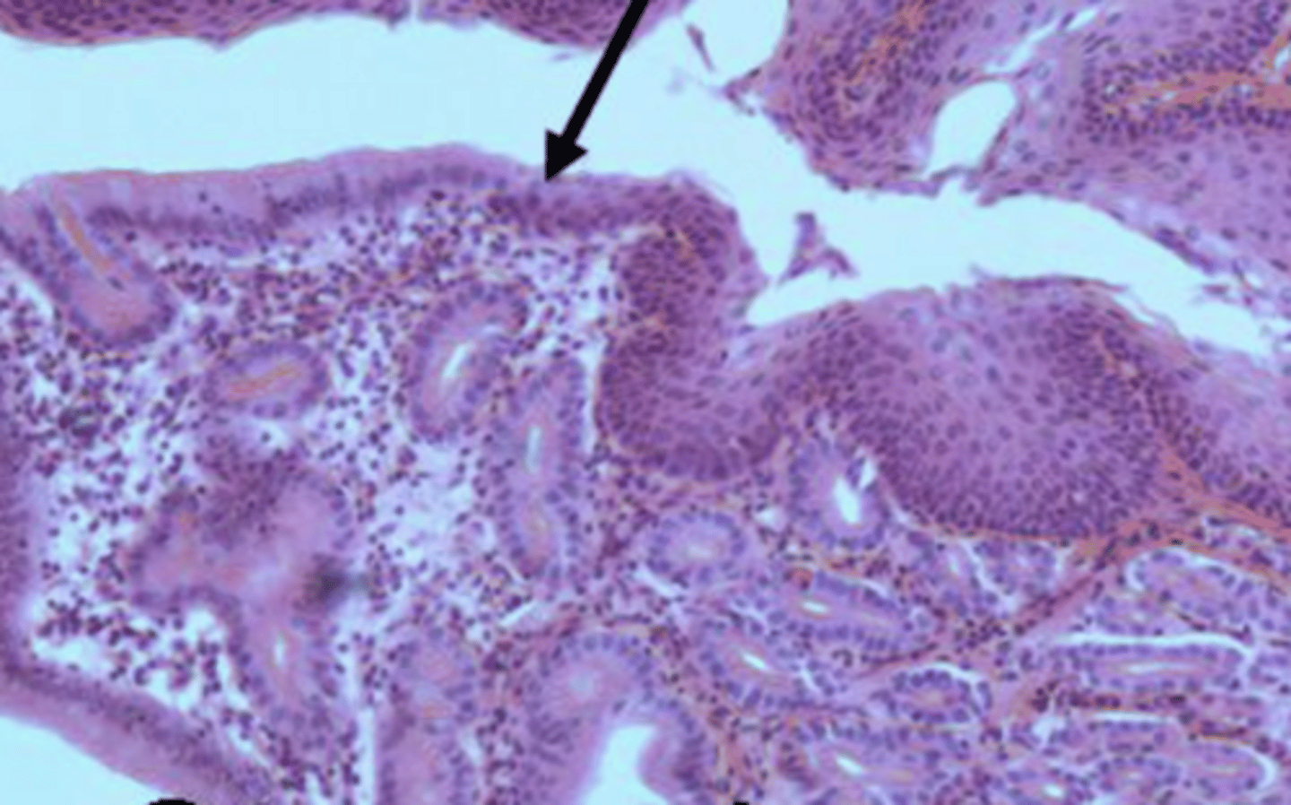 <p>Transition from strat squam to simple columnar epithelium</p>