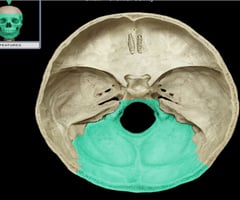 <p>Identify the bone.</p>