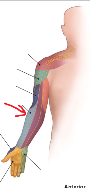 <p>The area where the red arrow is pointing is what dermatomal nerve?</p>