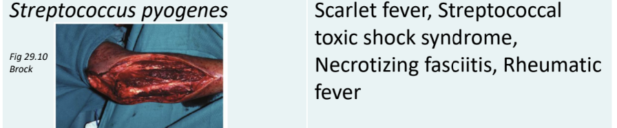 <p>Group A Streptococci such as S. pyogenes cause a range of infections including strep throat, scarlet fever, and skin infections. They can also lead to more severe conditions like<strong><mark data-color="red" style="background-color: red; color: inherit"> rheumatic fever and necrotizing fasciitis. </mark></strong></p>