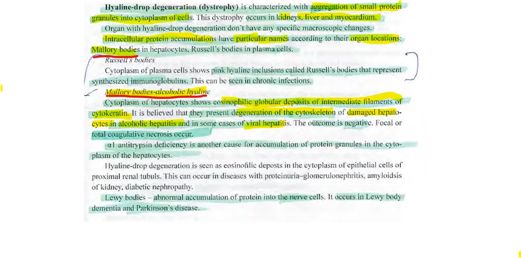 <p><strong><span>Mark the correct statement(s) for Mallory bodies?</span></strong> </p><p>a) they are accumulations of glycogen in the cytoplasm of the hepatocytes </p><p><strong>b) they are hyaline inclusions in the cytoplasm of the hepatocytes </strong></p><p>c) they are caused by consumption of toxic mushrooms </p><p><strong>d) they are seen in Wilson’s disease, liver cancer, primary biliary cirrhosis but mainly in alcoholic disease</strong></p>