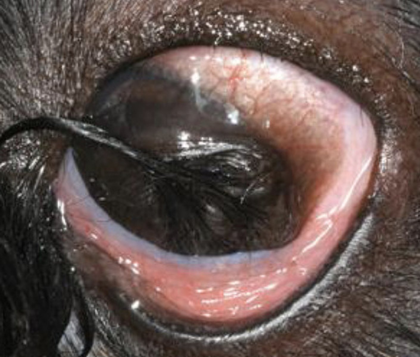 <p>What is the treatment for dermoids?</p>