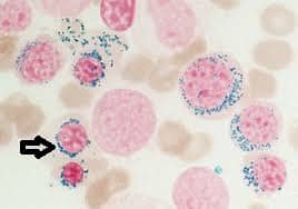 <p>Identify this type of red cell.</p>