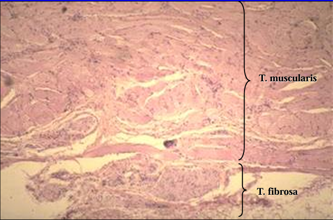 <p>Canine pelvic urethra. </p><p>The tunica muscularis and tunica fibrosa are shown. </p><p>The tunica fibrosa is the outer most layer and contains blood vessels, nerve fibers and fibrous connective tissue.</p>