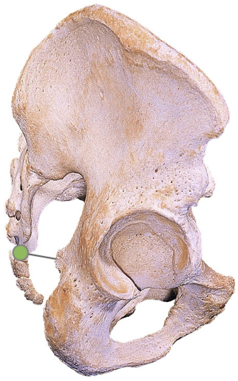 <p>Which bone landmark of the pelvic girdle is a pointy projection that extends from the posterior border of the ischium?</p>