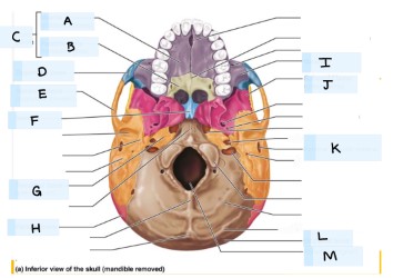 <p>What is A?</p>