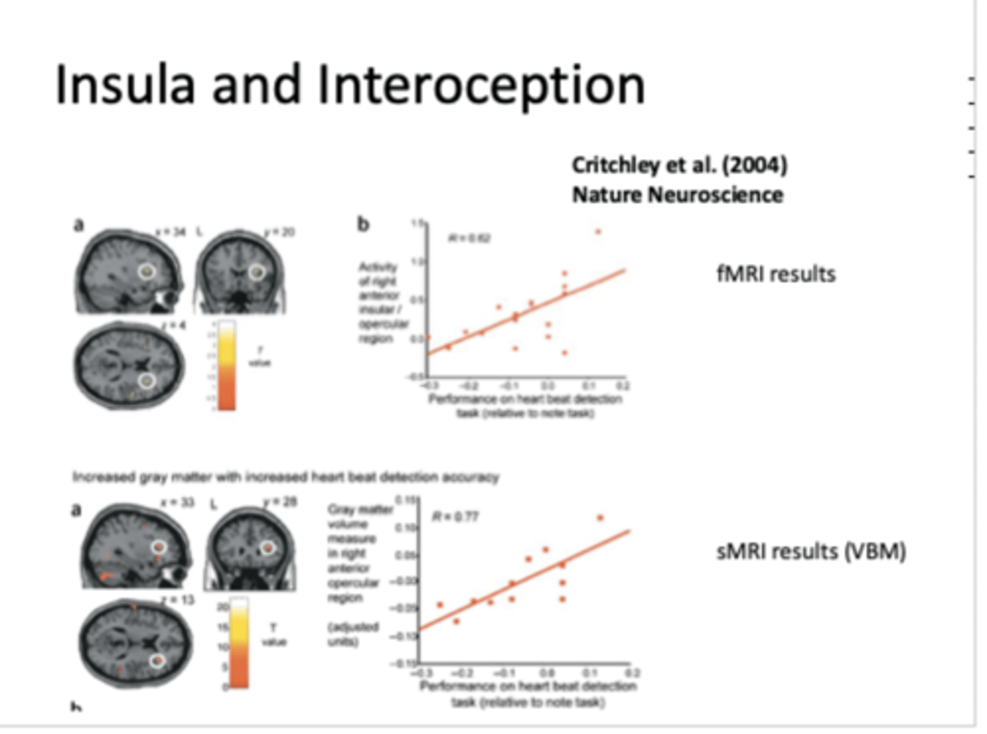 <p>Critchley et al. (2004)</p><p>- healthy individuals in MRI machine and count their heart beat</p><p>- the more activation in insula= better heart beat detection task</p><p>- and performance on task was associated with grey matter volume in insula</p><p>- insula importance in introspection and ANS</p>