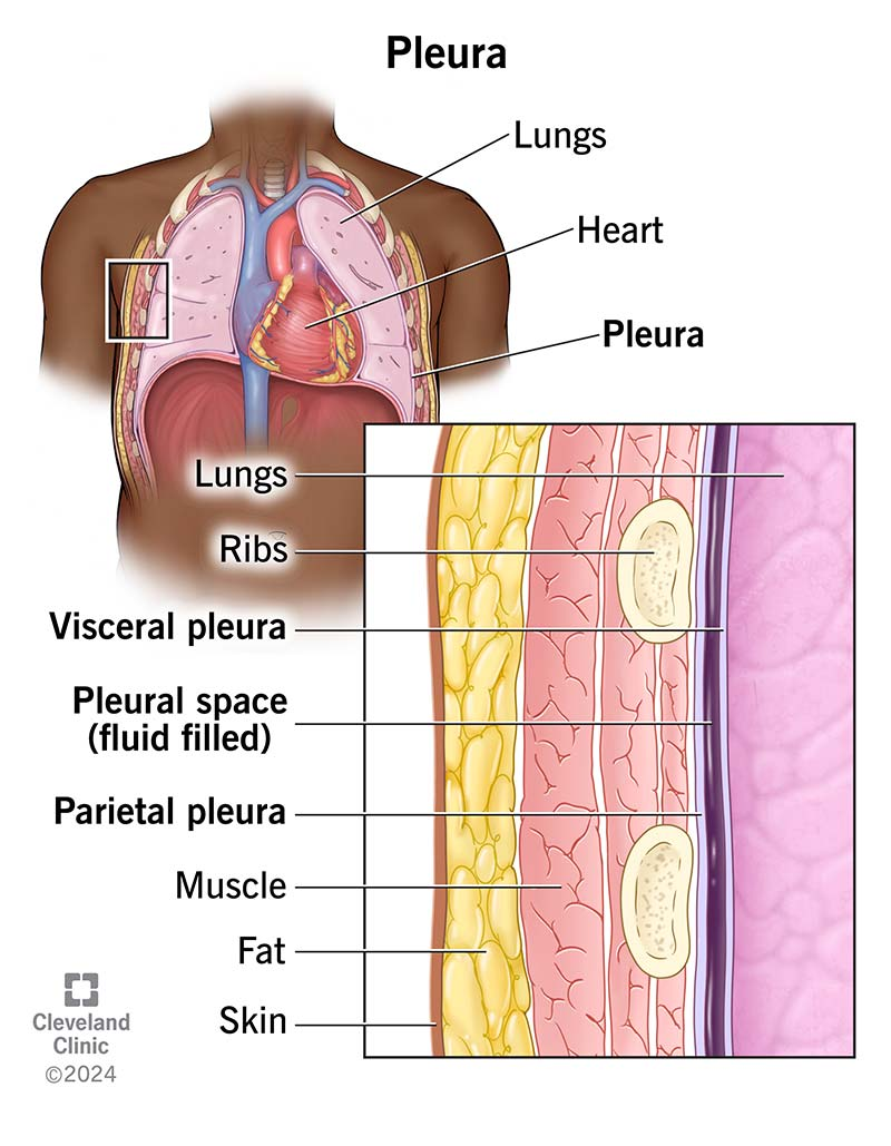 <p>outer layer of pleura lying closer to the ribs and chest wall</p>