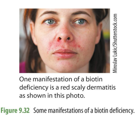 <p><strong>skin rash</strong></p><p>hair loss</p><p>convulsion</p><p>neurological dz</p><p>impaired growth in children</p>