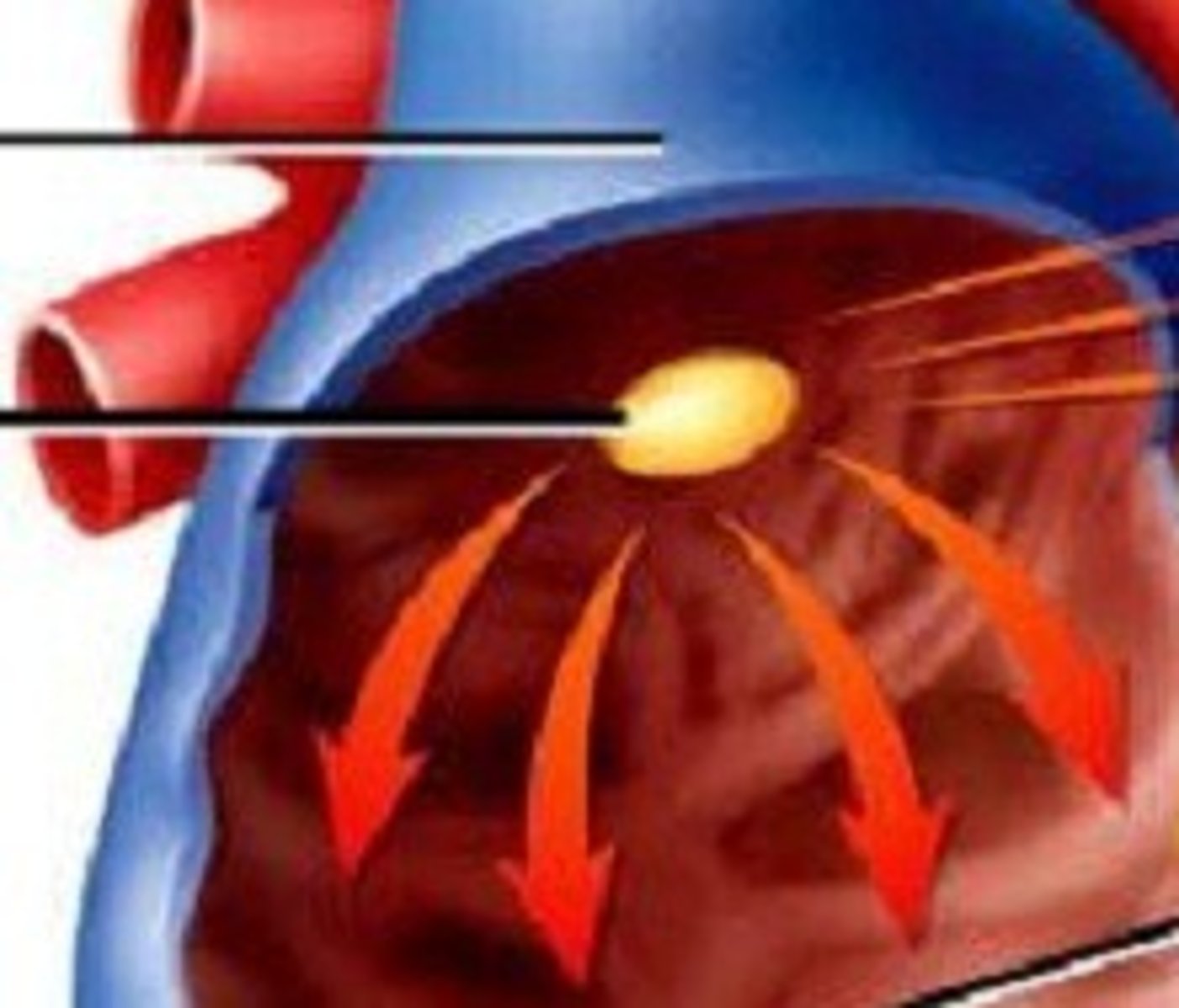 <p>the pacemaker of the heart, located in the wall of the right atrium, that sets the rate and timing at which all cardiac muscle cells contract</p>