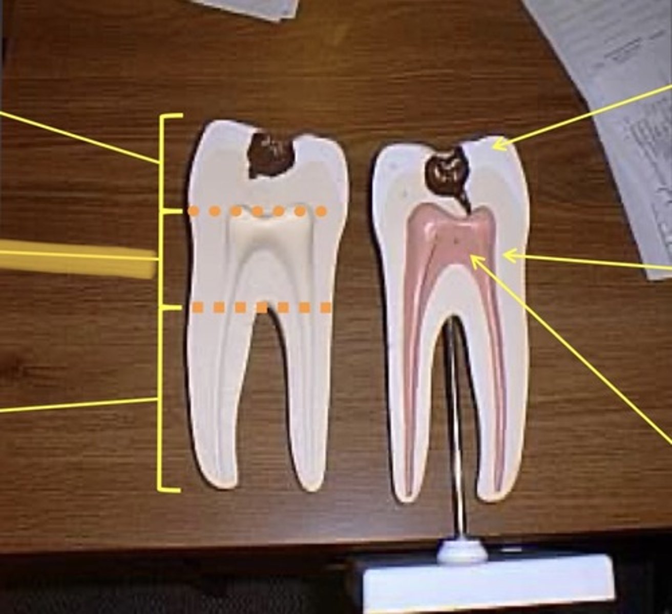 knowt flashcard image