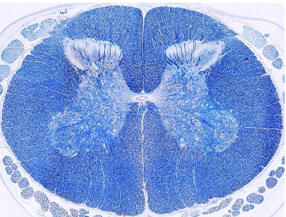 <p>Luxol-fast blue (LFB) and Toluidine blue</p><ul><li><p>observe myelin and white matter, stains tissue rich in DNA and RNA</p></li></ul><p></p>