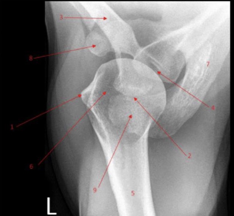 <p>Label the shoulder</p><p>bonus: which side is anterior?</p>