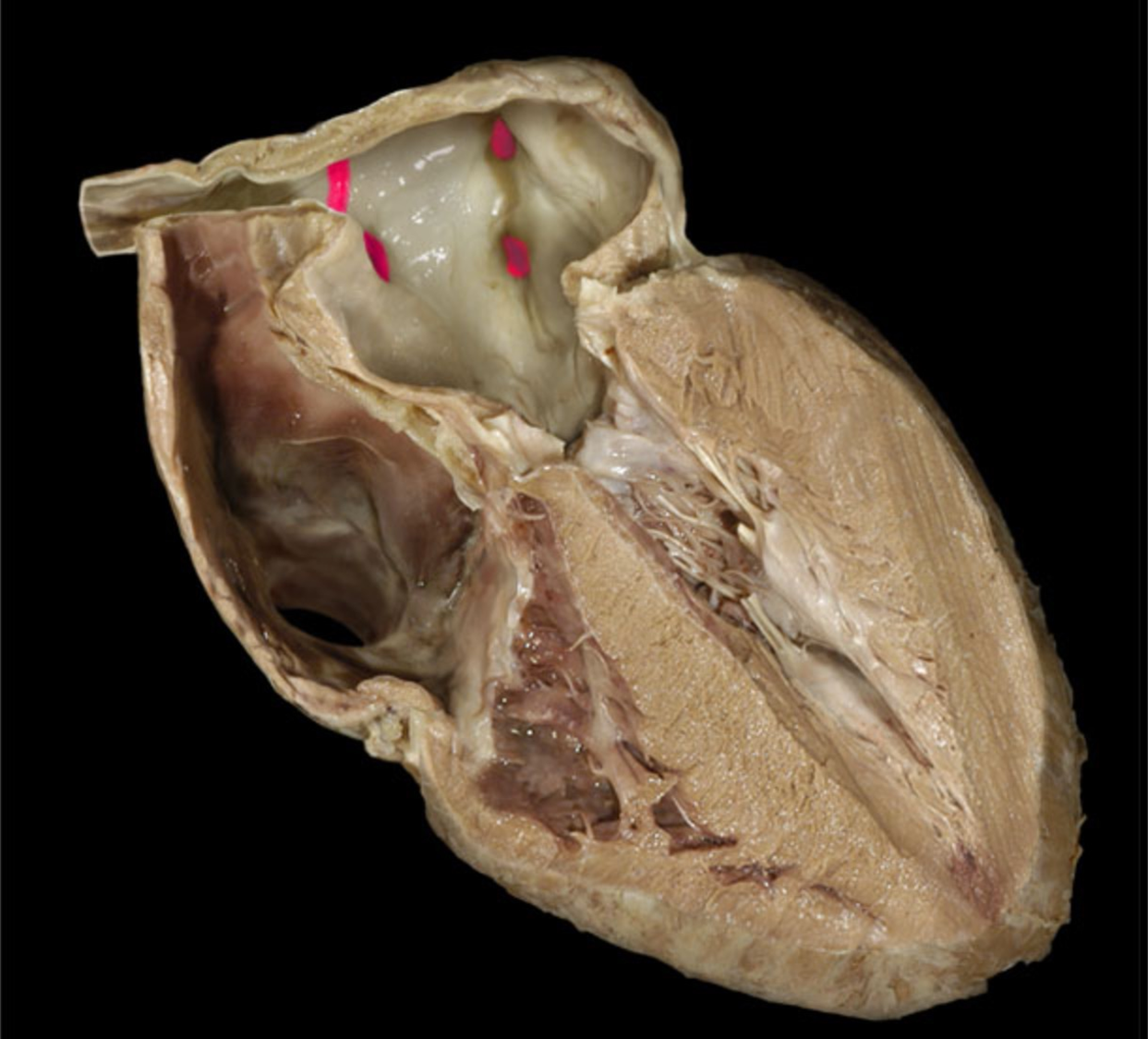 knowt flashcard image