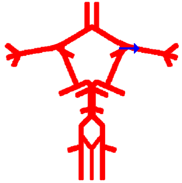 <p>Label this cerebral artery</p>