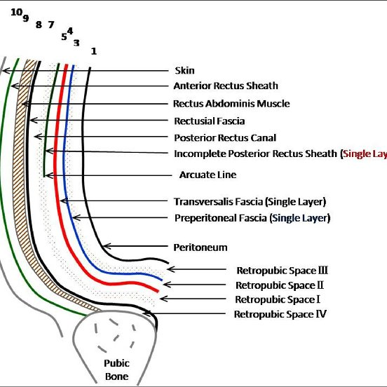 <p>No,</p><ul><li><p><strong>retropubic space</strong> (space of Retzius) is located between the pubic bone and the bladder, but it is <strong>not</strong> called the <strong>anterior cul-de-sac</strong></p></li><li><p><strong>anterior cul-de-sac</strong> refers specifically to the <strong>space between the bladder and the uterus</strong> in females (also called the vesicouterine pouch)</p></li></ul><p></p>
