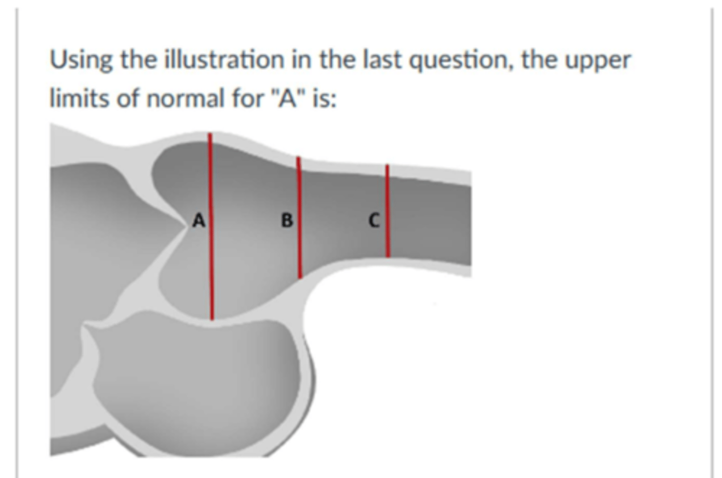 <p>3.7 cm</p>