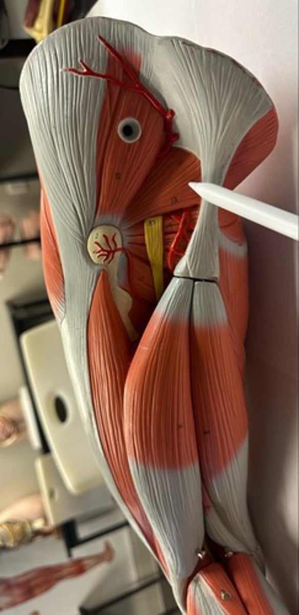 <p>What are the (3) attachments of the Piriformis?</p>