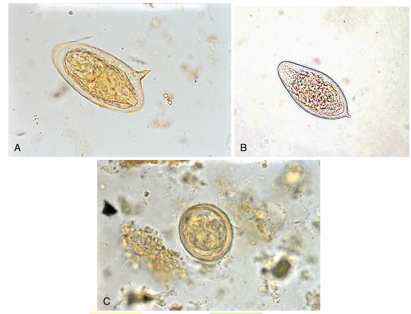<p>A genus of trematodes, commonly known as blood flukes.</p>