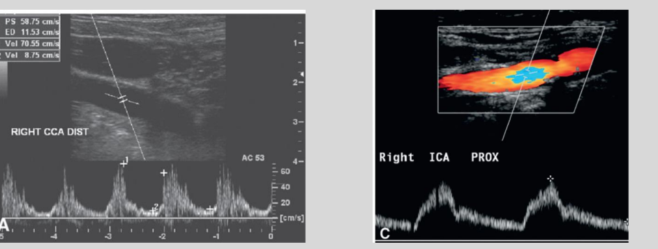 <p>what waveform is this</p>