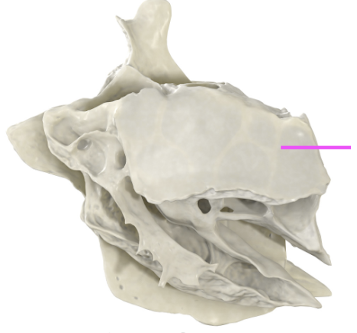 <p>What bone marking is this?</p>