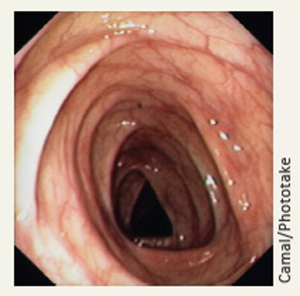 <p>Visual examination of a body cavity or canal using a specialized lighted instrument called an endoscope</p>