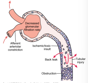 <p>mechanism of injury of Acute Tubular Necrosis</p>