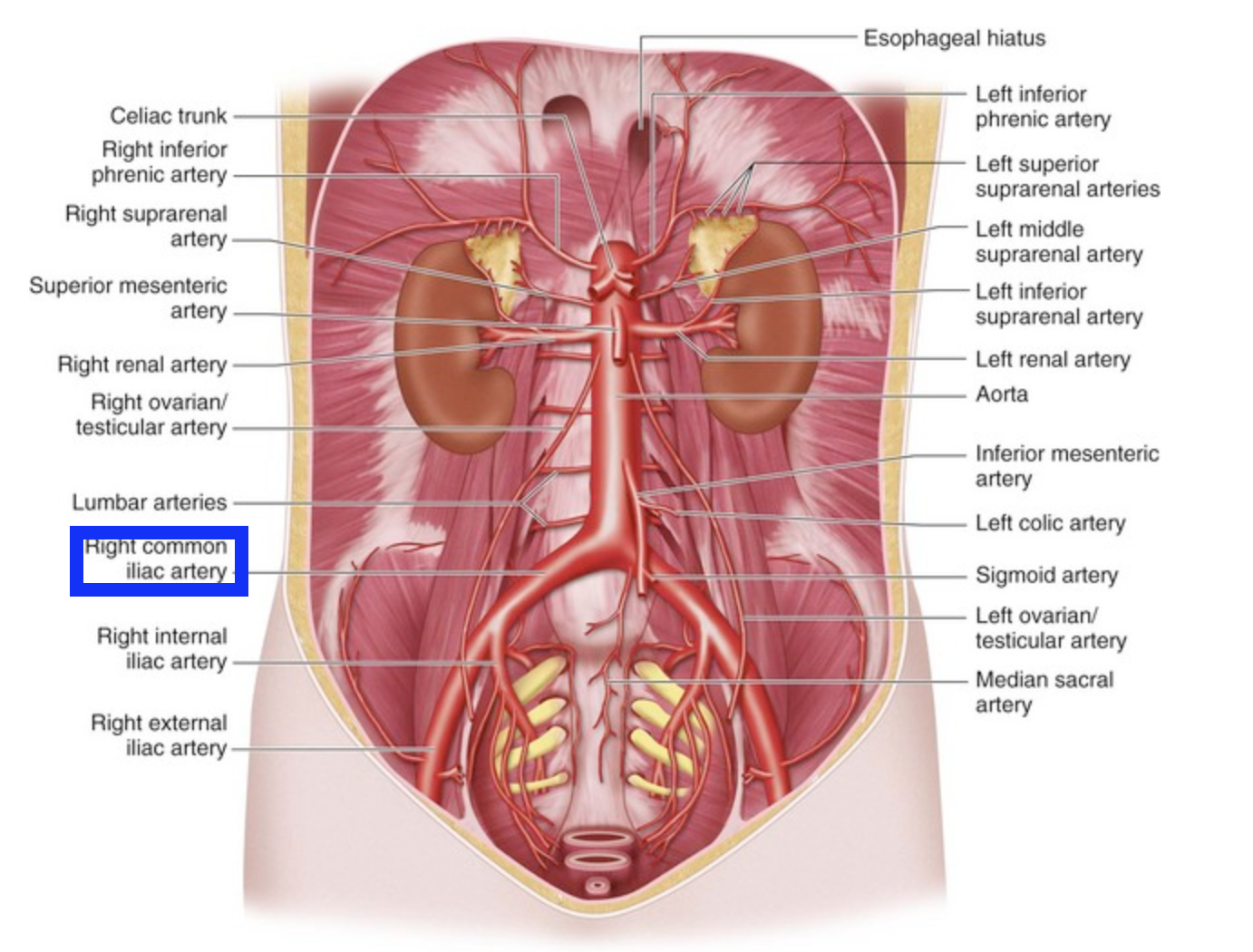 <p>left common iliac artery is directly on opposite side</p>