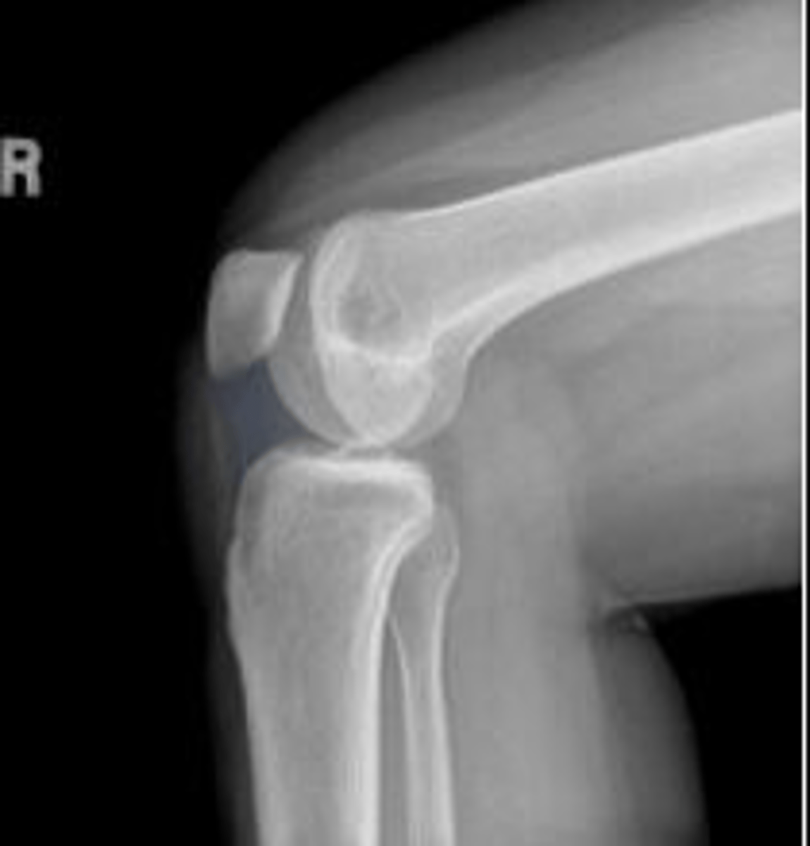 <p>What is outlined?</p>