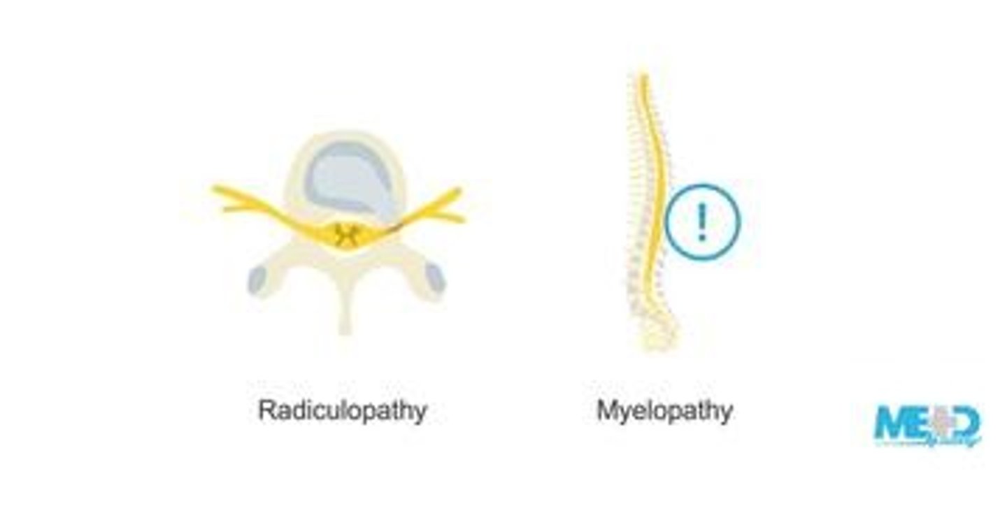 <p>Disruption of cervical spine nerves, often causing pain and weakness in the arms.</p>