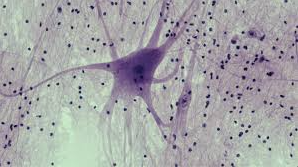 <p>What tissues type is this?</p>