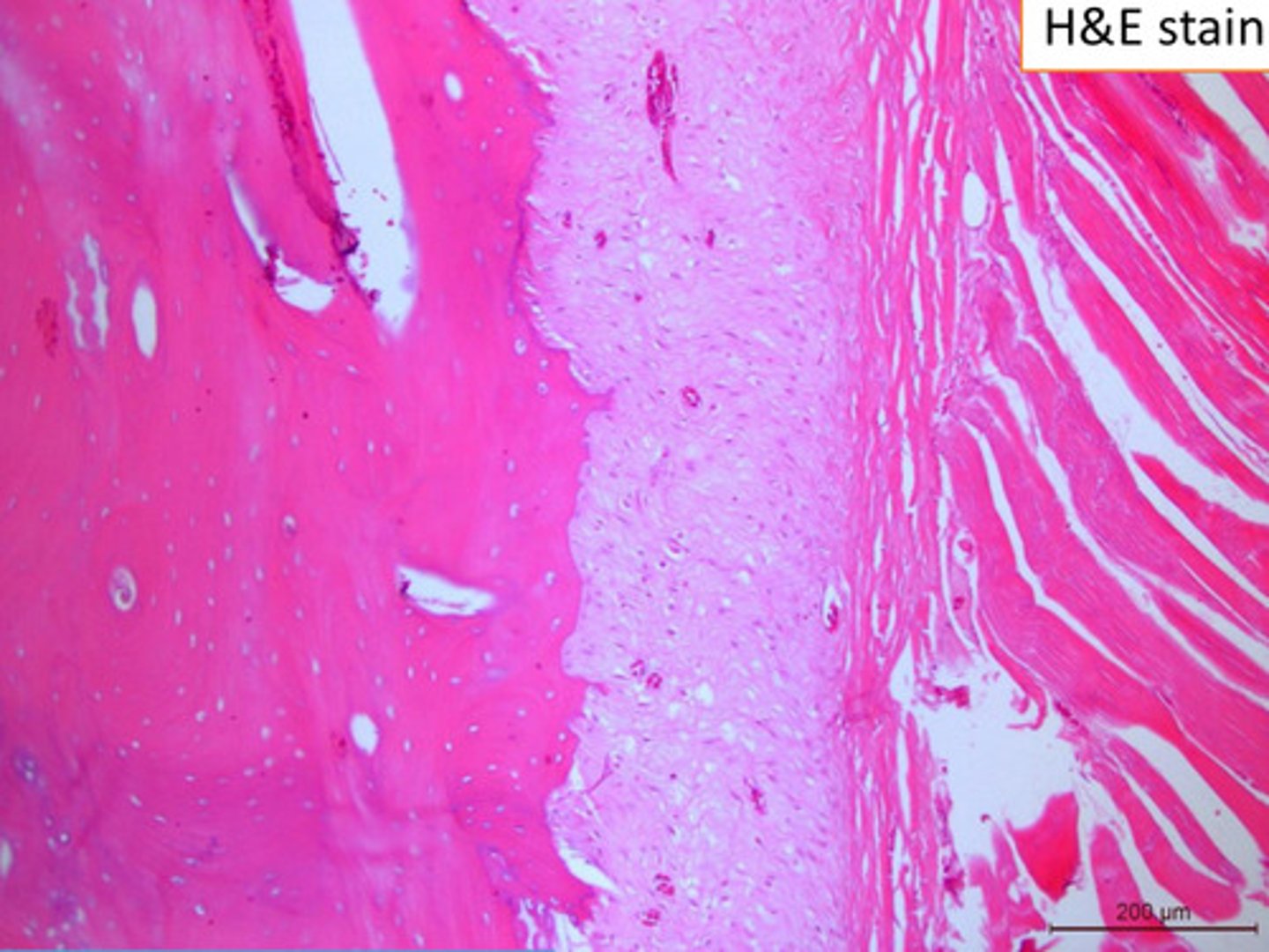 <p>Identify the type of bone growth:</p>