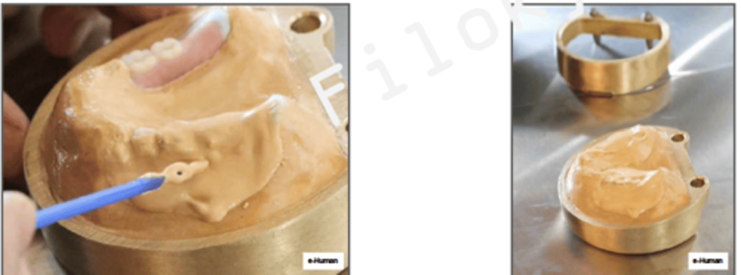 <p>ID the phase:</p>